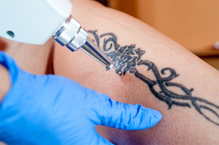 Is A Painless Tattoo Possible How To Reduce Tattoo Pain  Hush Anesthetic