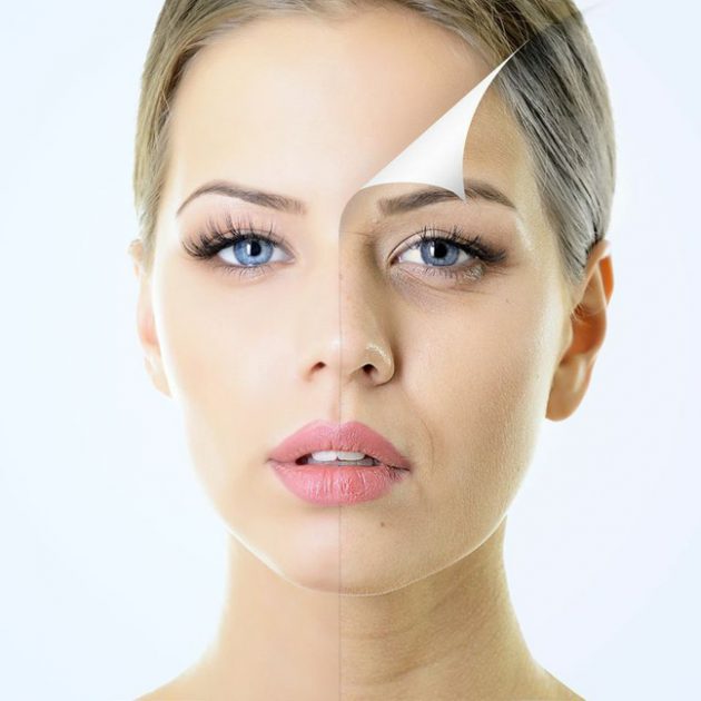 Laser Treatment: Skin Resurfacing