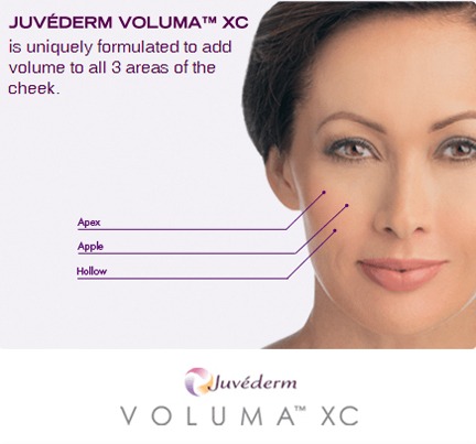 How Much Does Juvéderm Voluma XC Dermal Filler Cost?