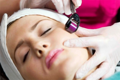 RF Microneedling Reduces Aging Lines And Wrinkles